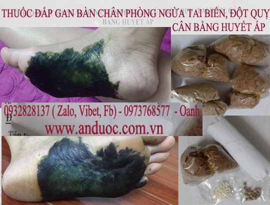 THUỐC ĐẮP GAN BÀN CHÂN NGỪA TAI BIẾN MỖI NĂM 1 LẦN