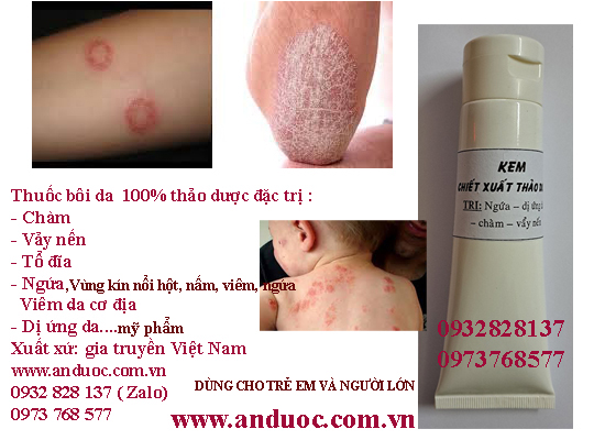 THUỐC BÔI ĐÔNG Y TRỊ NGỨA, NẤM, LÁC VÙNG KÍN