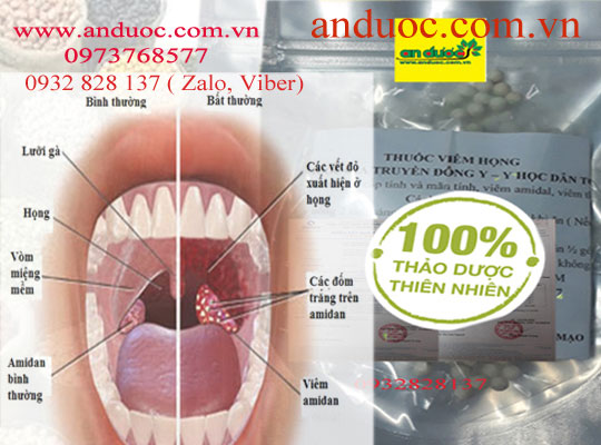 THUỐC NAM ĐẶC TRỊ VIÊM HỌNG, HO, NGỨA CỔ LÂU NĂM